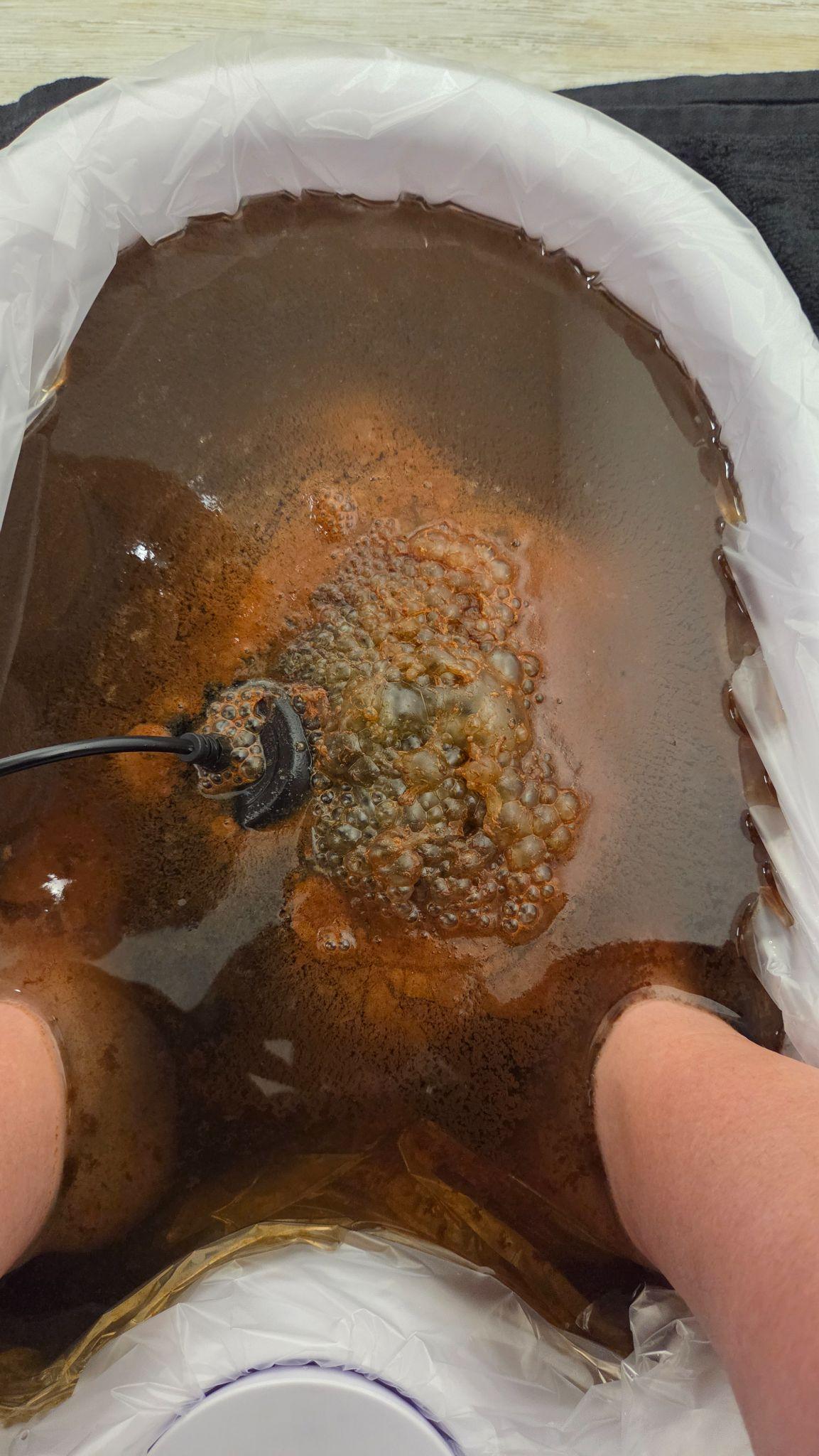 Ionic foot detox session at the end: water has changed color as toxins are released